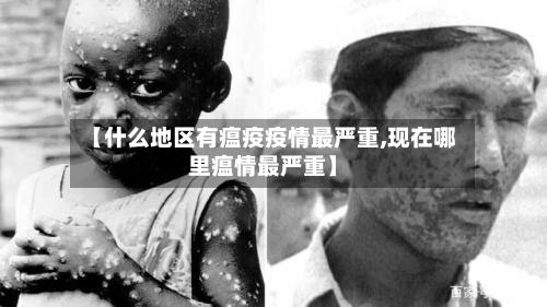 【什么地区有瘟疫疫情最严重,现在哪里瘟情最严重】