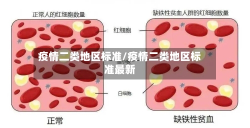 疫情二类地区标准/疫情二类地区标准最新