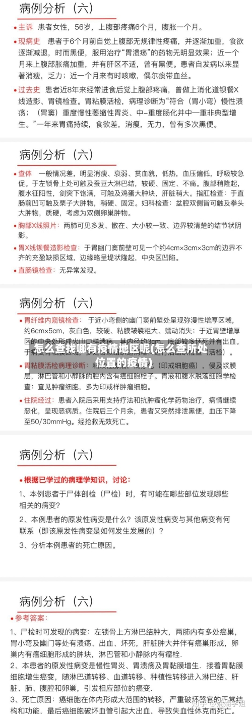 怎么查找哪有疫情地区呢(怎么查所处位置的疫情)-第2张图片